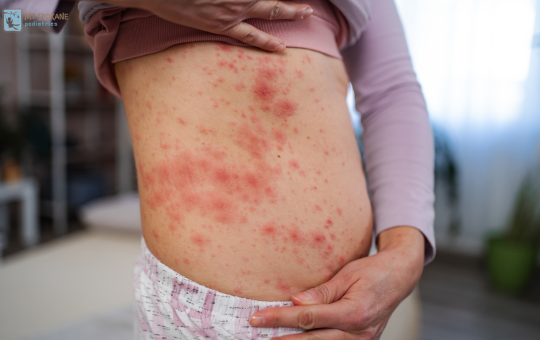 Baby rashes 101 Spokane pediatrician